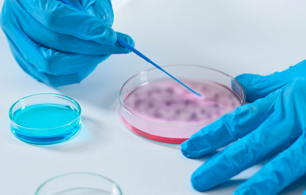 Diagnóstico mediante examen de cándida 