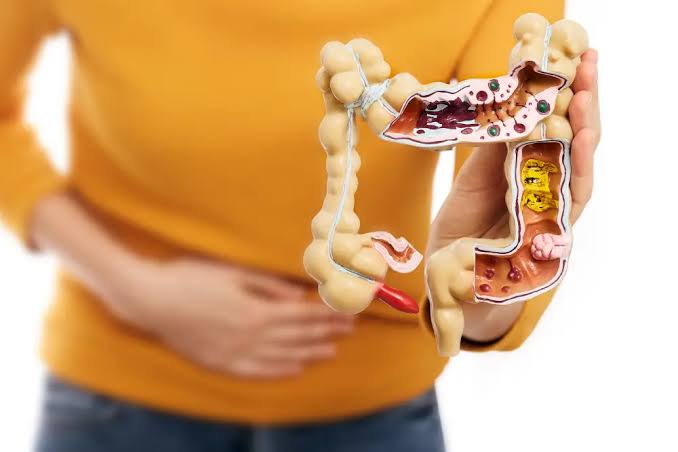 Tratamiento para enfermedad crónica del sistema digestivo